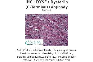 Image no. 1 for anti-Dysferlin (DYSF) (C-Term) antibody (ABIN2852394)
