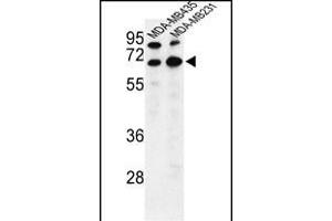 Western blot analysis of BEST2 Antibody (C-term) (ABIN653193 and ABIN2842742) in MDA-M,MDA-M cell line lysates (35 μg/lane). (Bestrophin 2 antibody  (C-Term))