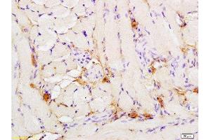 Immunohistochemistry (Paraffin-embedded Sections) (IHC (p)) image for anti-Nuclear Factor (erythroid-Derived 2)-Like 2 (NFE2L2) (pSer40) antibody (ABIN676673)