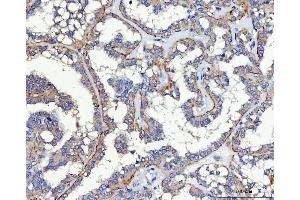 IHC analysis of SLC17A5 using anti-SLC17A5 antibody (ABIN7599315). (Solute Carrier Family 17 (Acidic Sugar Transporter), Member 5 (SLC17A5) (AA 1-365) antibody)