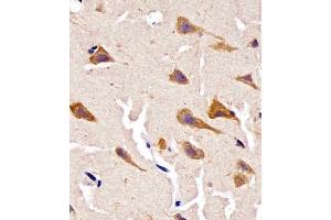 Immunohistochemistry (Paraffin-embedded Sections) (IHC (p)) image for anti-Peptidylprolyl Isomerase D (PPID) (AA 336-370) antibody (ABIN6243007)