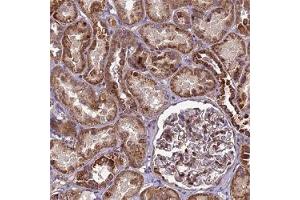 Immunohistochemical staining (Formalin-fixed paraffin-embedded sections) of human kidney shows strong cytoplasmic positivity in renal tubules. (RSPRY1 antibody)