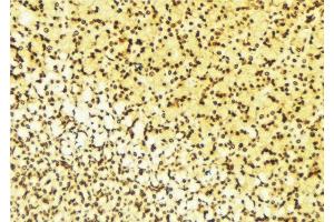 ABIN6276613 at 1/100 staining Human gastric tissue by IHC-P. (NET1 antibody  (C-Term))
