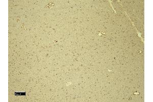 Immunohistochemistry (IHC) image for anti-Damage Specific DNA Binding Protein 1 (DDB1) (C-Term) antibody (ABIN184570)