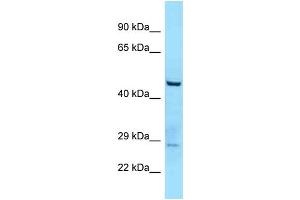 WB Suggested Anti-TTLL3 Antibody Titration: 1.