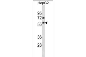 TRIM13 Antibody (N-term) (ABIN657208 and ABIN2850498) western blot analysis in HepG2 cell line lysates (35 μg/lane). (TRIM13 antibody  (N-Term))