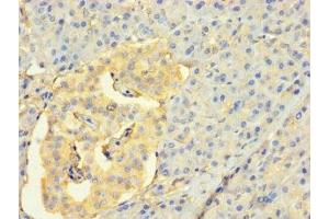 Immunohistochemistry of paraffin-embedded human pancreatic tissue using ABIN7158857 at dilution of 1:100 (CDC25C antibody  (AA 1-473))