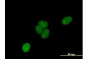 Immunofluorescence of purified MaxPab antibody to C1orf103 on HeLa cell. (C1orf103 antibody  (AA 1-436))