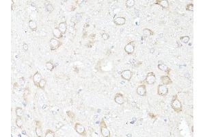 Immunohistochemistry of paraffin-embedded rat brain using MAP1LC3B antibody (ABIN6291775) at dilution of 1:100 (40x lens).