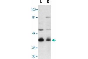 Western blot analysis of Dffb in mouse lung (L) and kidney (K) tissue lysates with Dffb polyclonal antibody  at 1 : 500 dilution. (DFFB antibody  (AA 314-329))