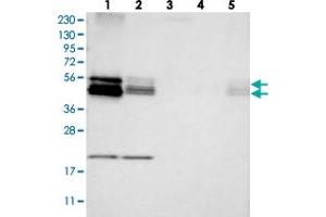 Western blot analysis of Lane 1: RT-4, Lane 2: U-251 MG, Lane 3: Human Plasma, Lane 4: Liver, Lane 5: Tonsil with BNIP2 polyclonal antibody . (BNIP2 antibody)