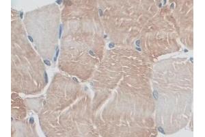 Detection of MYO1D in Rat Skeletal muscle Tissue using Polyclonal Antibody to Myosin ID (MYO1D) (Myosin ID antibody  (AA 512-788))