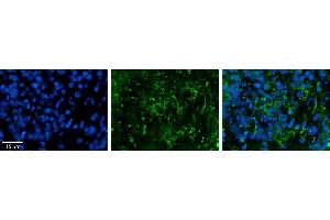 Rabbit Anti-ZDHHC17 Antibody     Formalin Fixed Paraffin Embedded Tissue: Human Pineal Tissue  Observed Staining: Cytoplasmic in vesicles and processes of pinealocytes  Primary Antibody Concentration: 1:100  Secondary Antibody: Donkey anti-Rabbit-Cy3  Secondary Antibody Concentration: 1:200  Magnification: 20X  Exposure Time: 0. (ZDHHC17 antibody  (Middle Region))
