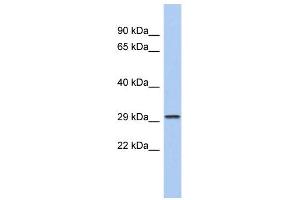 WB Suggested Anti-CACNG6 Antibody Titration:  0. (CACNG6 antibody  (N-Term))