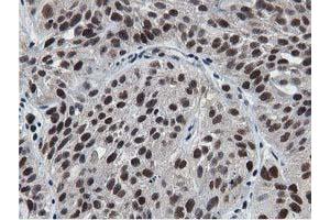 Image no. 2 for anti-5'-Nucleotidase Domain Containing 1 (NT5DC1) antibody (ABIN1499835) (NT5DC1 antibody)