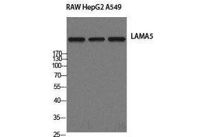 Western Blot analysis of RAW264. (Laminin alpha 5 antibody)