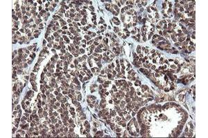 Image no. 5 for anti-V-Ets Erythroblastosis Virus E26 Oncogene Homolog 2 (ETS2) (AA 90-349) antibody (ABIN1491703) (ETS2 antibody  (AA 90-349))