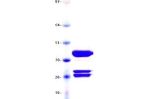 BRAF Protein (DYKDDDDK Tag)