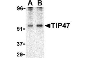 Western Blotting (WB) image for anti-Perilipin 3 (PLIN3) (N-Term) antibody (ABIN1031617) (PLIN3 antibody  (N-Term))