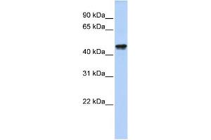 WB Suggested Anti-QTRTD1 Antibody Titration:  0. (QTRTD1 antibody  (N-Term))