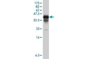 Western Blot detection against Immunogen (37 KDa) . (PCBP1 antibody  (AA 181-280))