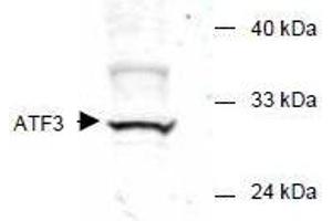 Image no. 1 for anti-Activating Transcription Factor 3 (ATF3) (AA 113-130) antibody (ABIN401262) (ATF3 antibody  (AA 113-130))