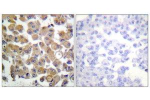 Immunohistochemistry (IHC) image for anti-Transforming Growth Factor, beta 1 (TGFB1) (C-Term) antibody (ABIN1848795) (TGFB1 antibody  (C-Term))