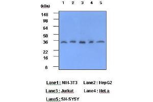 Cell lysates of NIH-3T3, HepG2, Jurkat, HeLa and SH-SY5Y (each 40 ug) were resolved by SDS-PAGE, transferred to PVDF membrane and probed with anti-human CRP (1:1000). (CRP antibody  (AA 19-224))