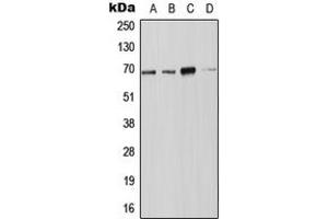 Western blot analysis of NOX4 expression in JAR (A), Jurkat (B), SP2/0 (C), PC12 (D) whole cell lysates.
