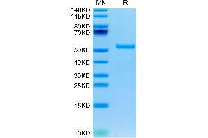 CHRDL1 Protein (AA 28-456) (His tag)