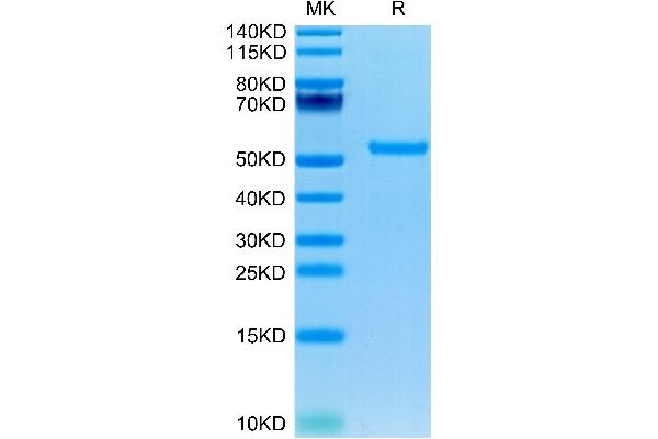 CHRDL1 Protein (AA 28-456) (His tag)