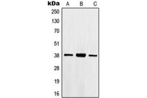 Western blot analysis of HOXB2 expression in Jurkat (A), HepG2 (B), A549 (C) whole cell lysates.