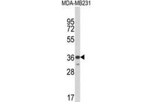 Western blot analysis of MICA Antibody (Center) in MDA-MB231 cell line lysates (35ug/lane).