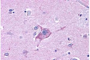 Anti-NPY5R antibody  ABIN1049125 IHC staining of human brain, neurons and glia.