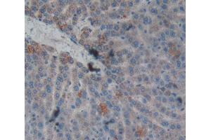 IHC-P analysis of liver tissue, with DAB staining. (CPB2 antibody  (AA 164-417))