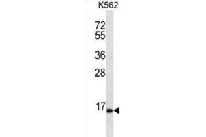 Western Blotting (WB) image for anti-Serine Peptidase Inhibitor, Kazal Type 8 (SPINK8) antibody (ABIN2996842) (SPINK8 antibody)