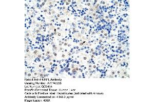 Rabbit Anti-HNRPL Antibody  Paraffin Embedded Tissue: Human Liver Cellular Data: Hepatocytes Antibody Concentration: 4. (HNRNPL antibody  (N-Term))