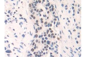 Immunohistochemistry (IHC) image for anti-Family with Sequence Similarity 19 (Chemokine (C-C Motif)-Like), Member A3 (FAM19A3) (AA 44-130) antibody (ABIN7441964)