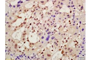 Formalin-fixed and paraffin embedded mouse placenta labeled with Rabbit Anti-AMIGO2 Polyclonal Antibody, Unconjugated (ABIN1386548) at 1:200 followed by conjugation to the secondary antibody and DAB staining (AMIGO2 antibody  (AA 21-120))