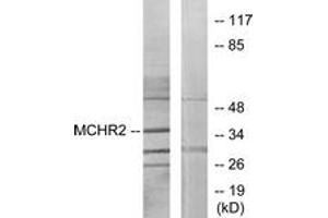 Western blot analysis of extracts from HuvEc cells, using MCHR2 Antibody. (MCHR2 antibody  (AA 291-340))