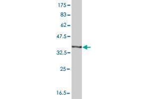 Western Blot detection against Immunogen (37. (HBA1 antibody  (AA 33-142))