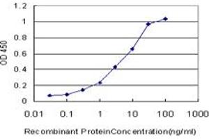 Detection limit for recombinant GST tagged PSPH is approximately 0. (PSPH antibody  (AA 1-100))