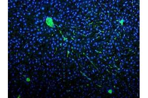IF analysis of VWF using anti-VWF antibody (ABIN3042349).