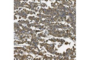 IHC analysis of ALDH1L1 using anti-ALDH1L1 antibody (ABIN7601093). (ALDH1L1 antibody  (AA 282-424))