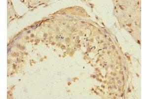 Immunohistochemistry of paraffin-embedded human testis tissue using ABIN7172192 at dilution of 1:100 (TIGD4 antibody  (AA 301-512))