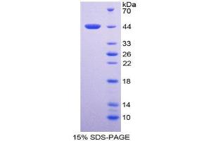 SDS-PAGE (SDS) image for Cardiac Troponin T (cTnT) (AA 2-100) protein (His tag,GST tag) (ABIN1171505)