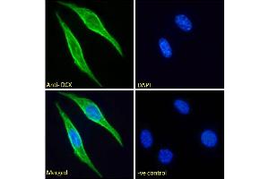 ABIN6391363 Immunofluorescence analysis of paraformaldehyde fixed NIH3T3 cells, permeabilized with 0. (Doublecortin antibody  (Internal Region))