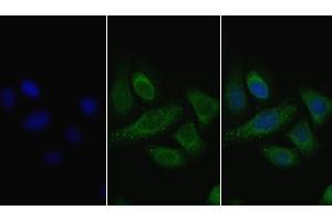 Detection of LPL in Human Hela cell using Polyclonal Antibody to Lipoprotein lipase (LPL) (Lipoprotein Lipase antibody  (AA 28-474))