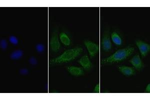 Detection of LPL in Human Hela cell using Polyclonal Antibody to Lipoprotein lipase (LPL) (Lipoprotein Lipase antibody  (AA 28-474))