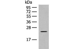 Western blot analysis of Rat heart tissue lysate using CLEC3B Polyclonal Antibody at dilution of 1:650